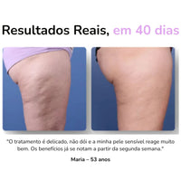 Massageador Anticelulite Pro + 2 Óleos de BRINDE
