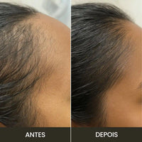 Escova de Terapia Capilar: TheraBrush Smarts 4 em 1