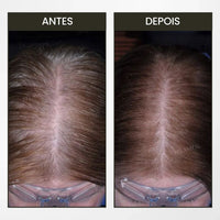 Pente BreoBrush: Terapia de Luz, Massageador e Difusor